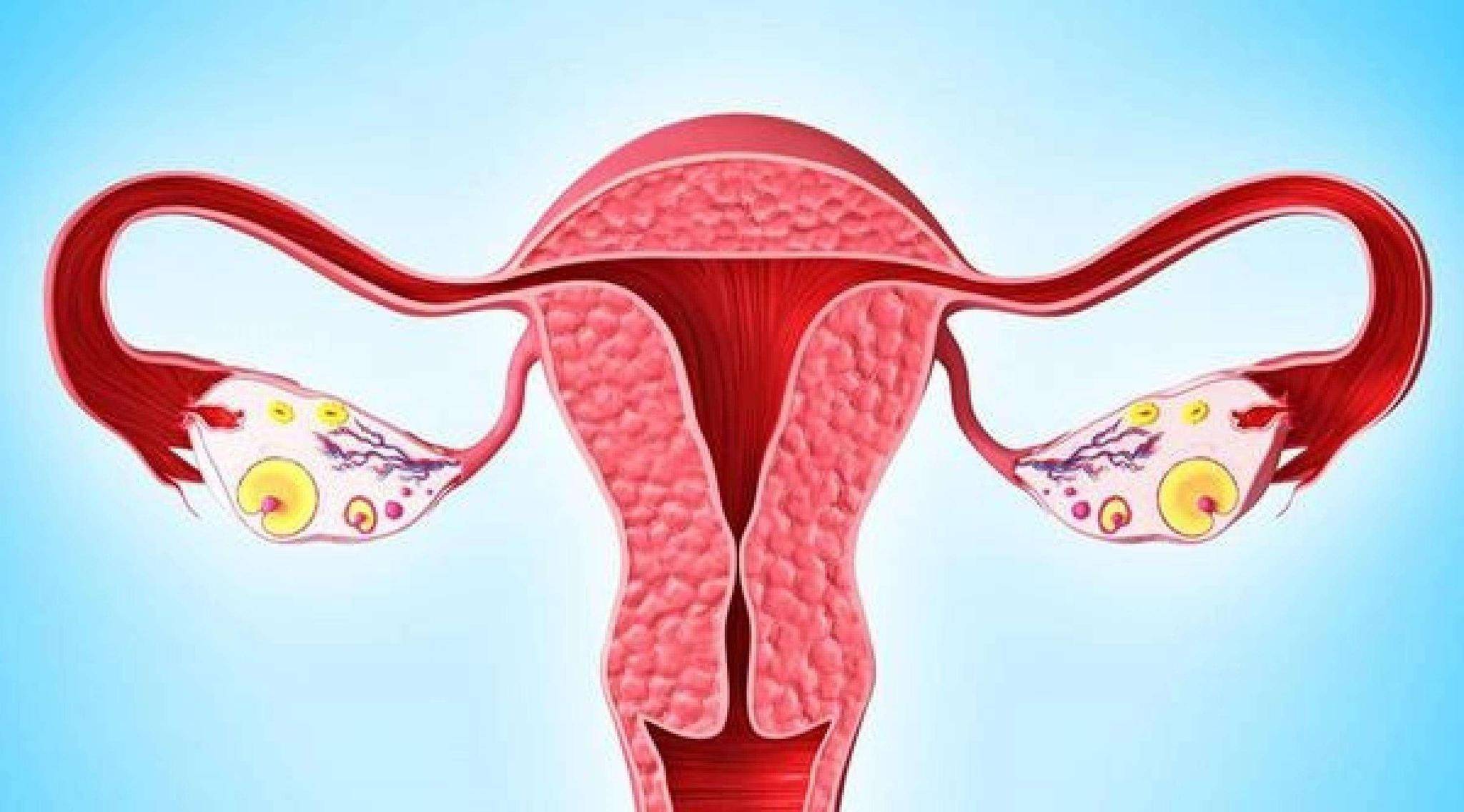 长期宫寒可能导致卵巢疾病