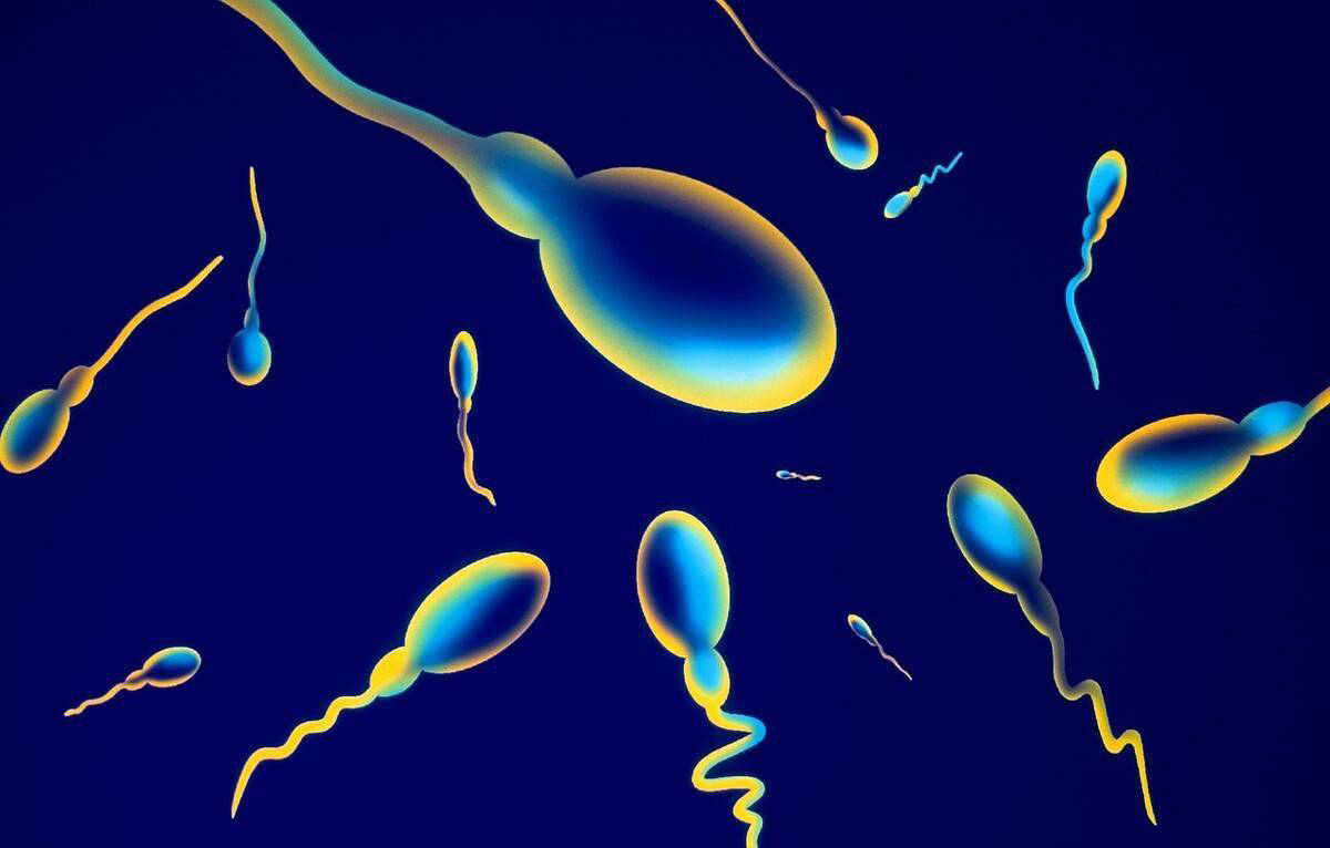 精子质量差会导致胚胎停育