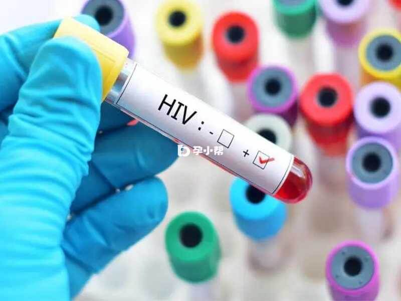 洗精+试管是国际通用 HIV 人群辅助生殖方案