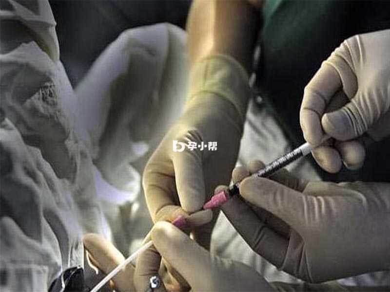 试管取卵流程不算复杂