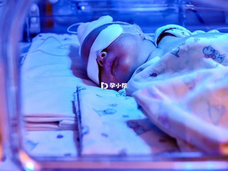 火棉胶婴儿可以通过皮肤护理进行缓解