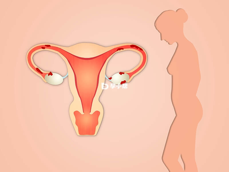 拮抗剂方案适合卵巢早衰的女性