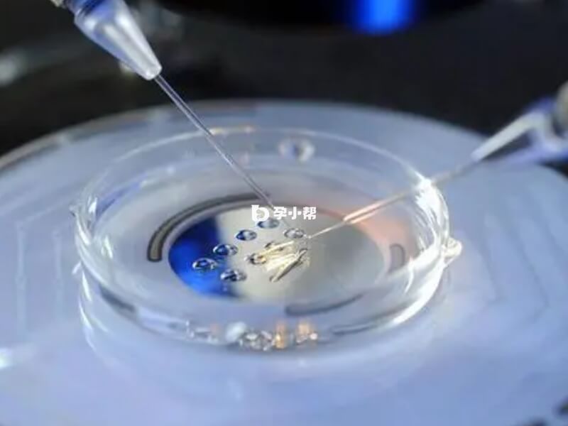 拮抗方案一般需要12天左右促排