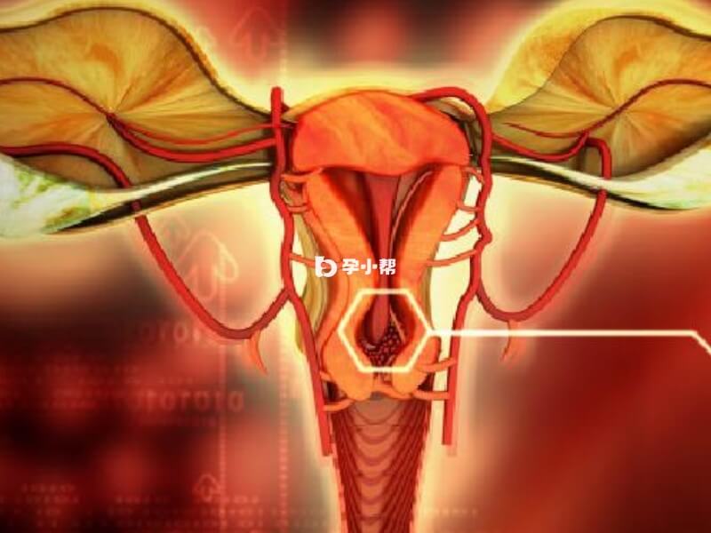 输卵管积水能否自怀要分情况讨论