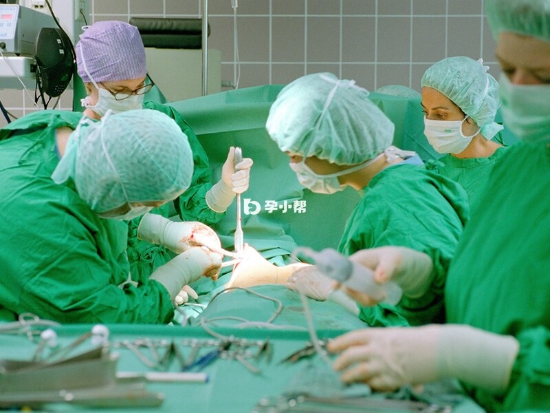 剖腹产要进行术前准备