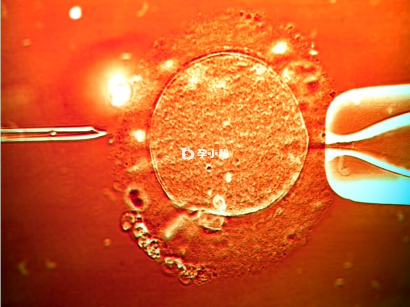 阿儿法助孕中心试管医生是比较优秀的