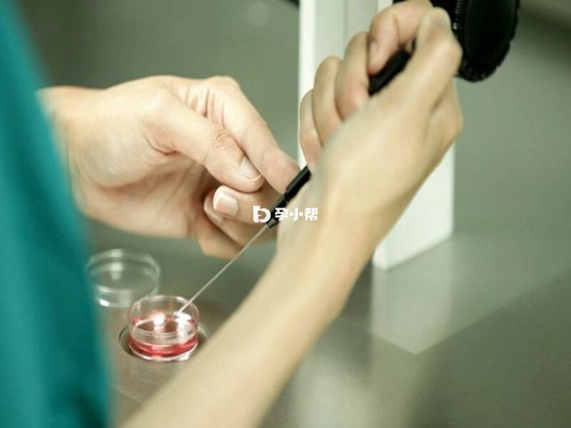 不同患者在RFG医院做试管的费用不同