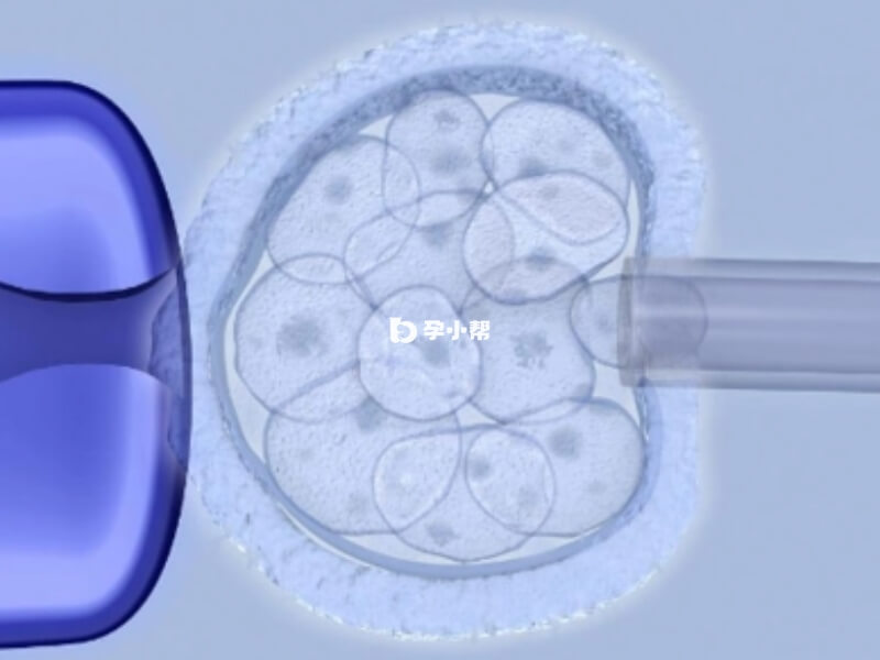 不同试管技术的囊胚移植成功率不同