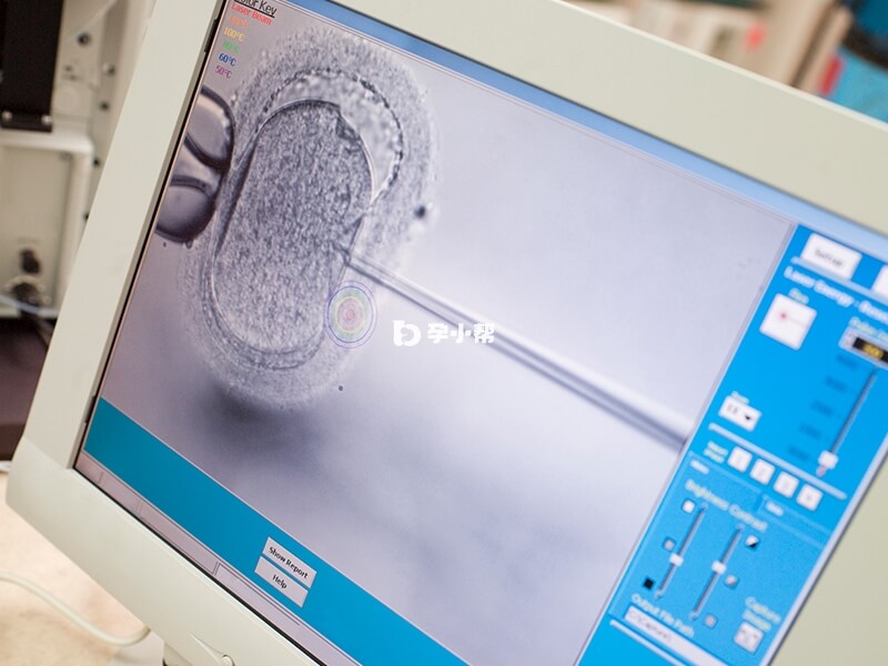 试管移植后要观察两个小时