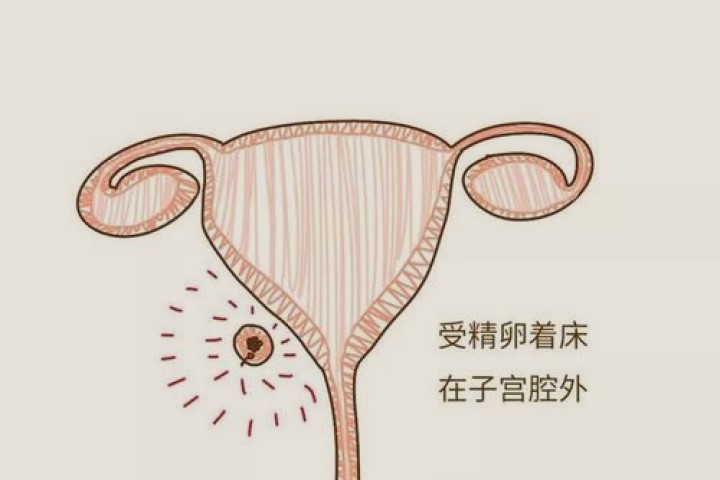 孕7周子宫位置示意图图片