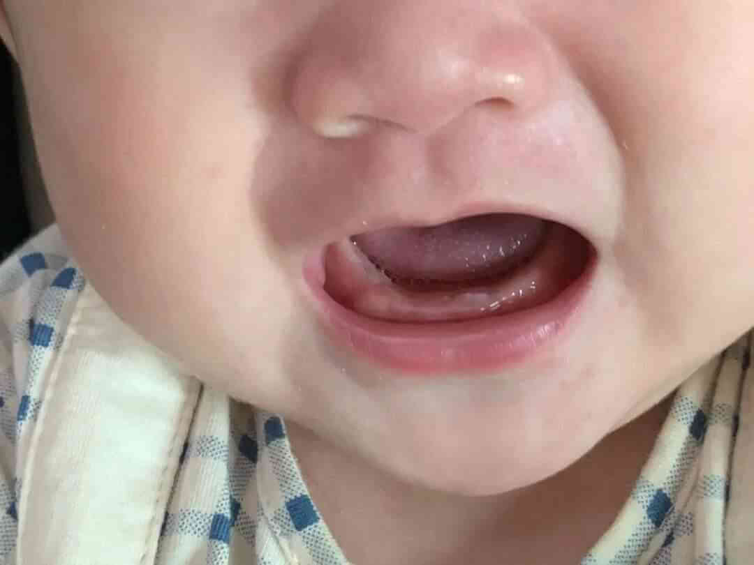 宝宝要长牙齿时的图片图片