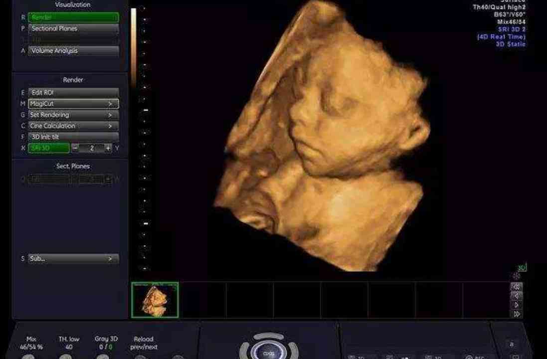 六个月胎儿图片真实图片