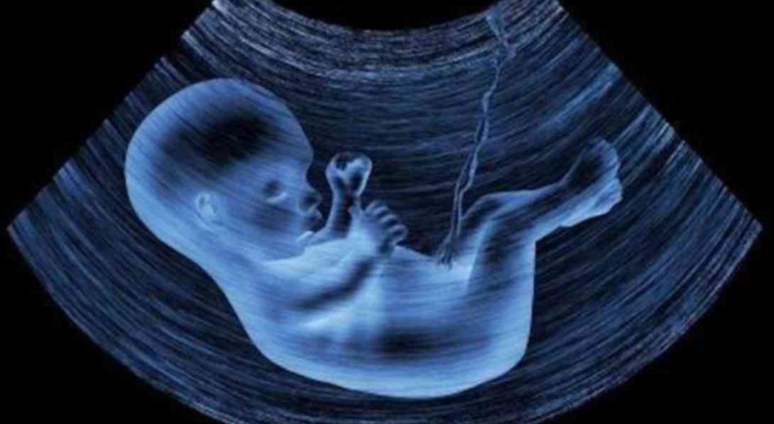 怀孕28周胎儿图欣赏终于看清楚宝宝真人长啥样了