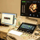 #四维彩超多少钱