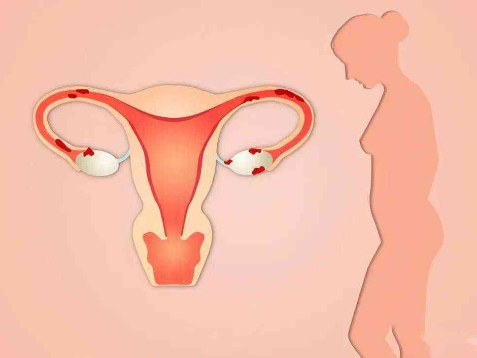 子宫有问题容易导致胎位异常