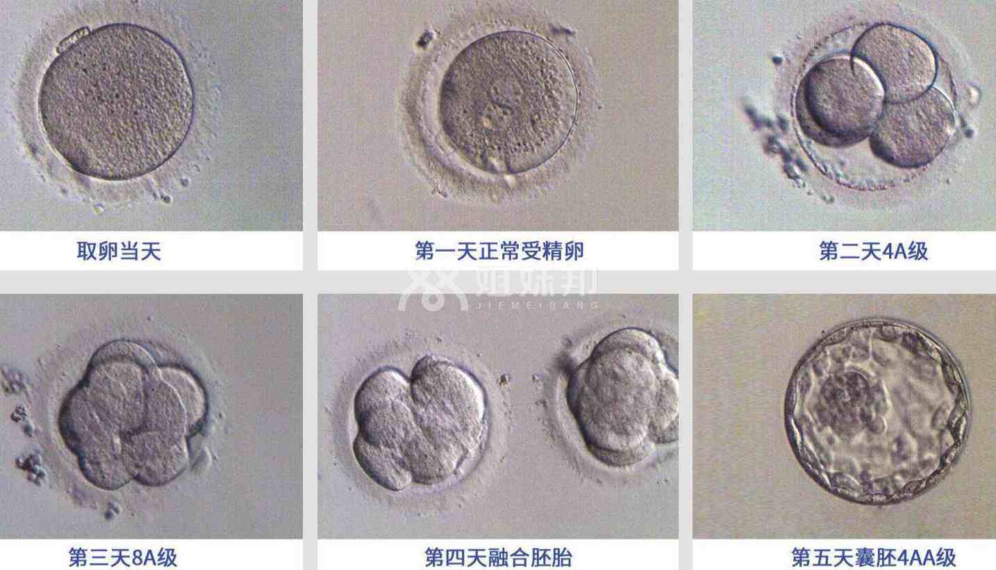 不同类型胚胎成功率也不同