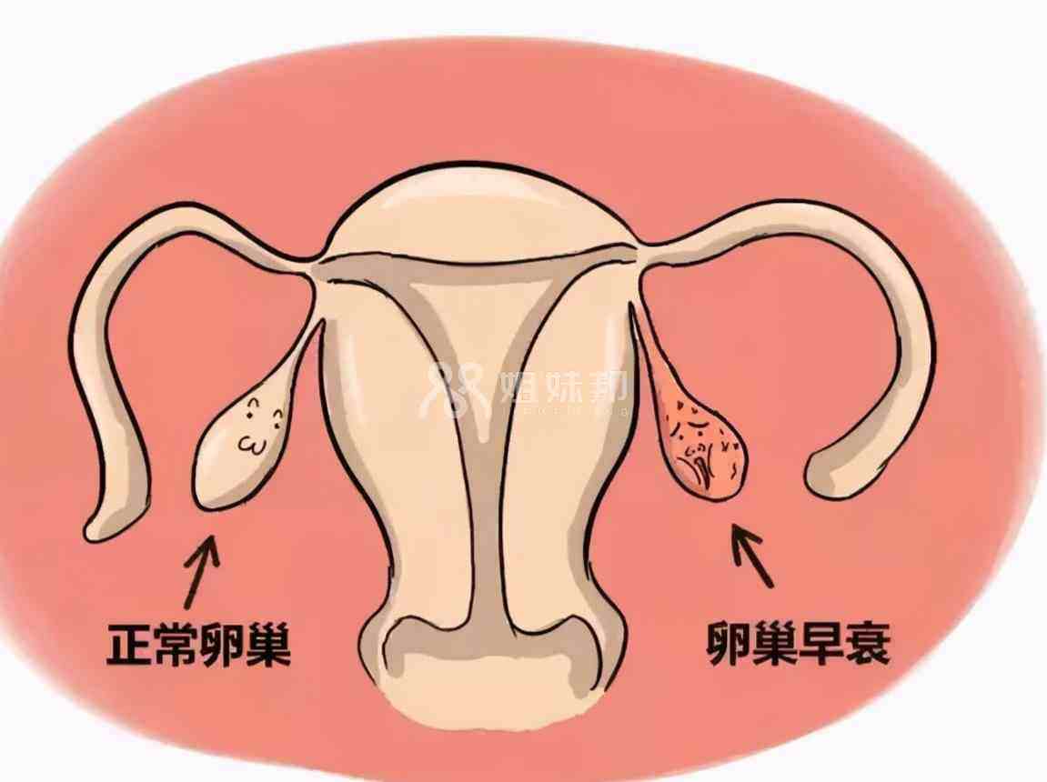 女性可以在卵巢早衰前冷冻卵子